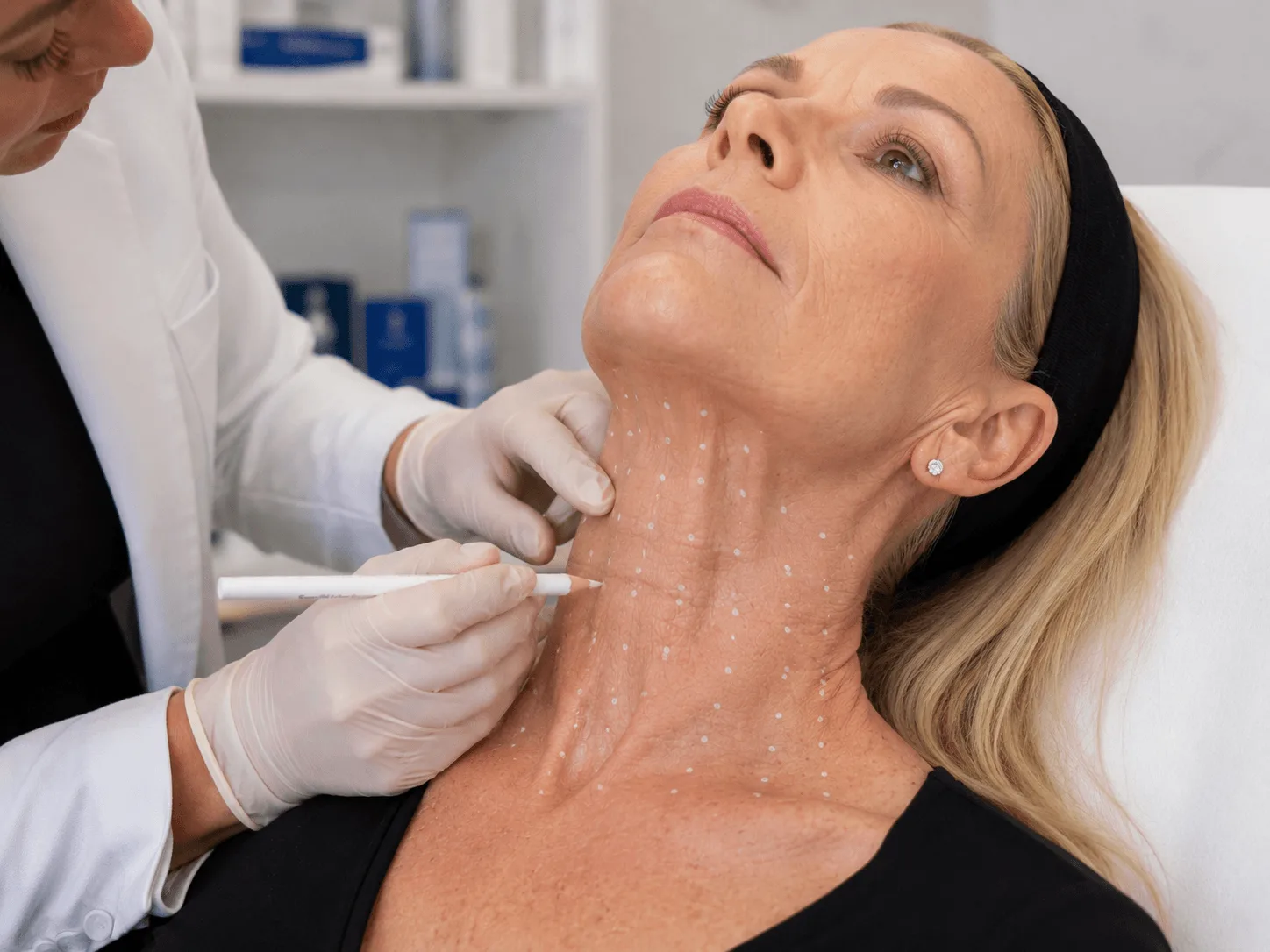 Marking the platysmal bands before neck treatment