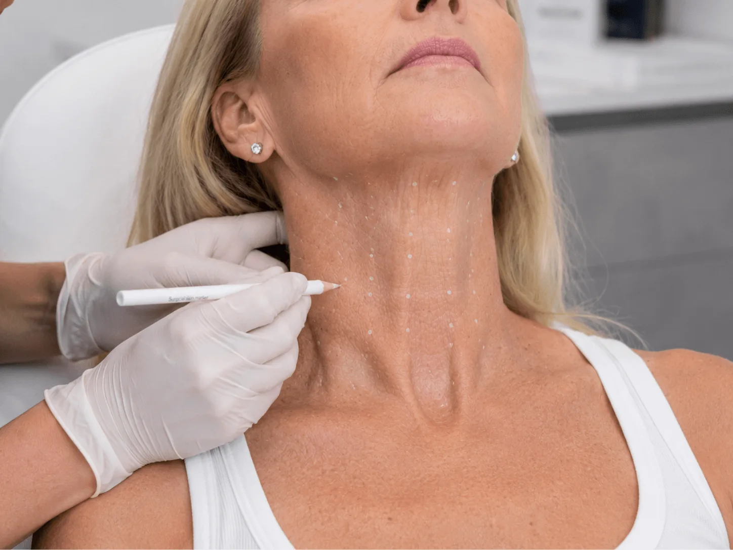 A practitioner mapping the platysmal bands before treatment